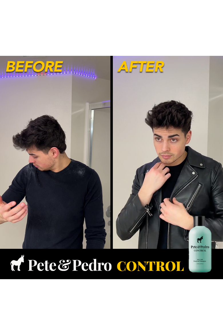 CONTROL Extra-Strength Anti-Dandruff & Anti-Itch Shampoo, Alternate, color, None