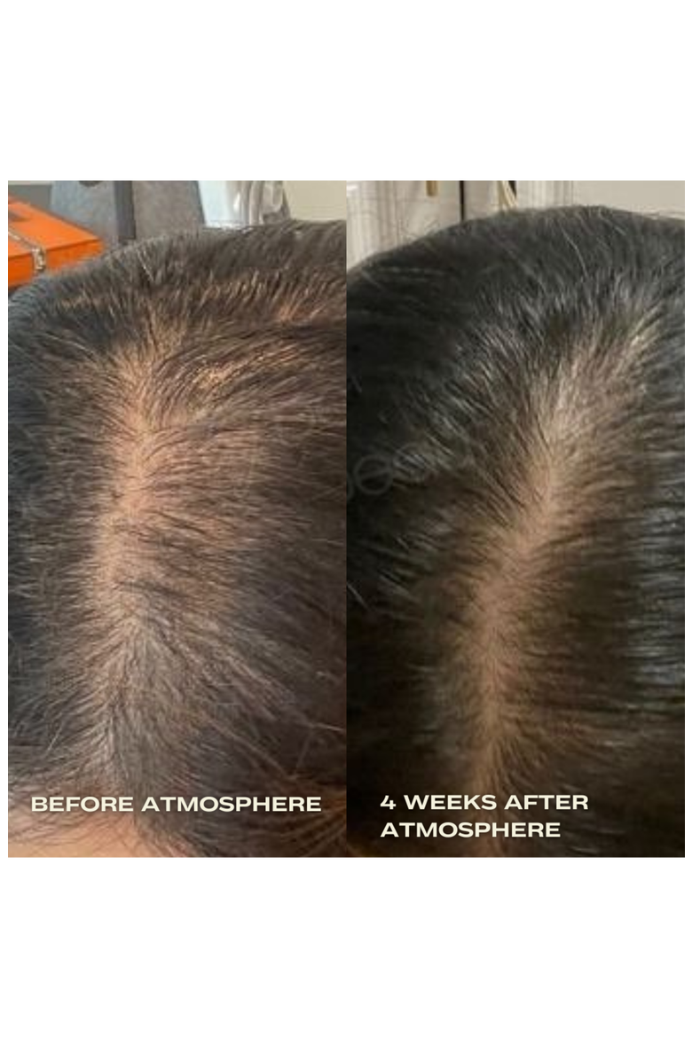 Hair Density & Stress Reset Ritual - Bestsellers Bundle, Alternate, color, Multiple colors
