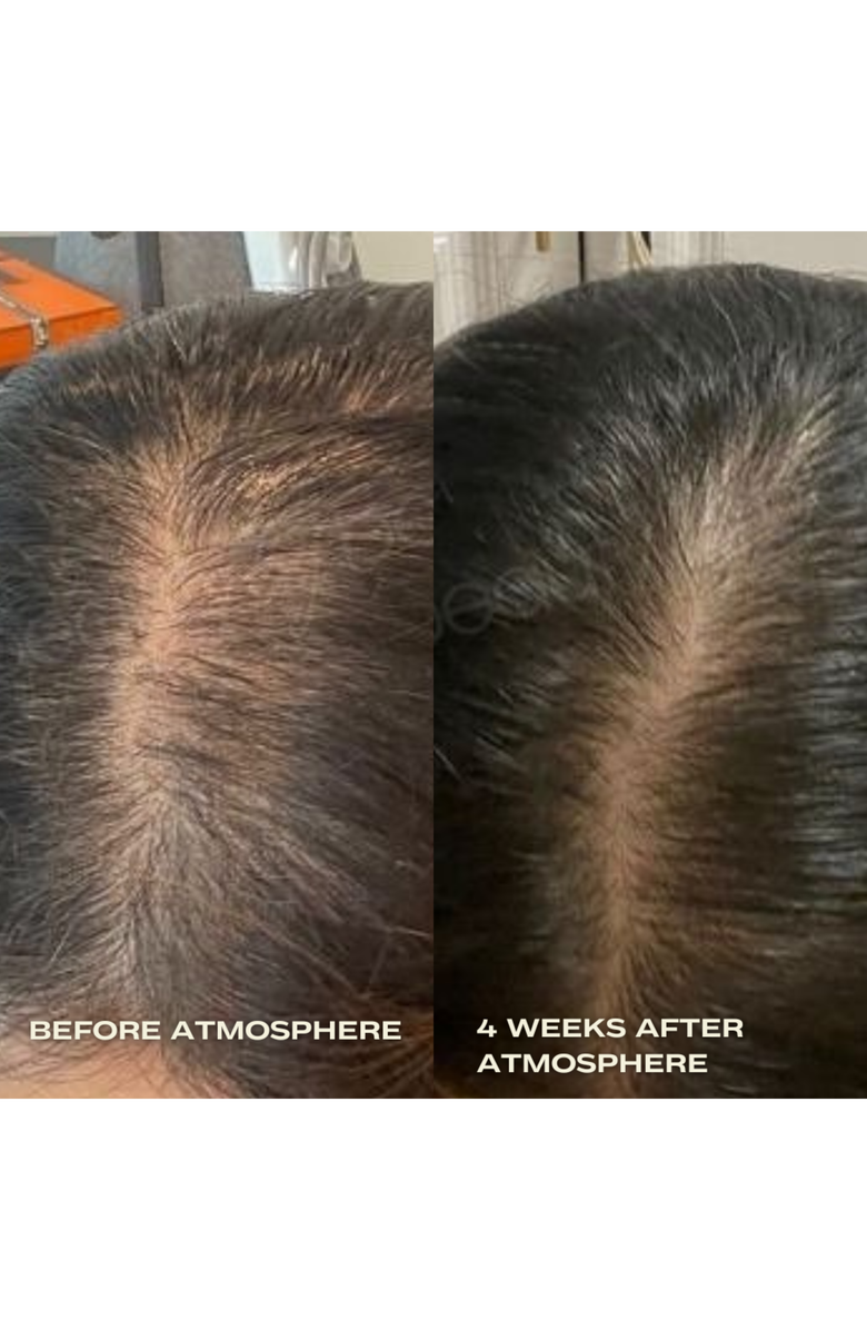 Luna Nectar Atmosphere Multi-Peptide Hair Density & Scalp Serum, Alternate, color, 1.69 Oz.