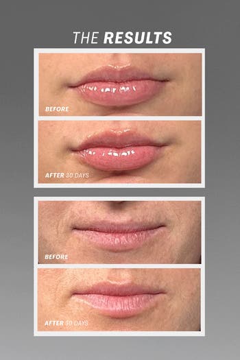 Lip Oasis Glossy Treatment