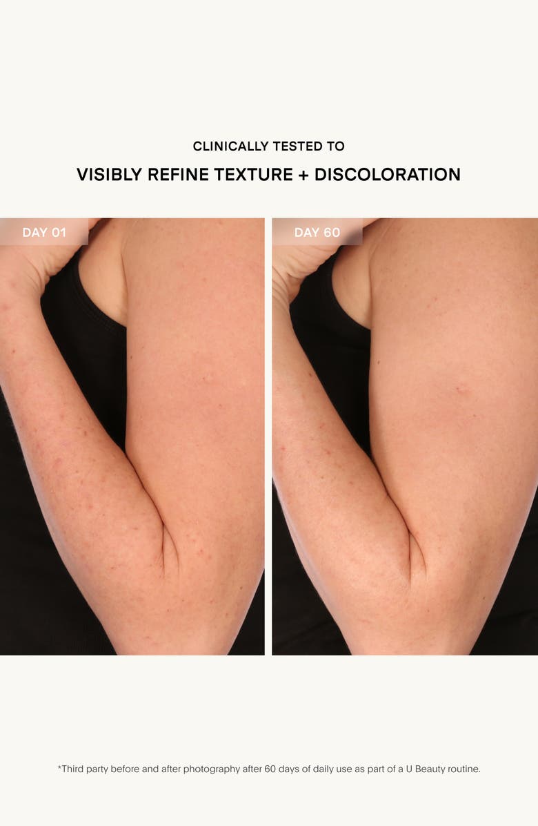 U Beauty Resurfacing Body Compound, Alternate, color, 