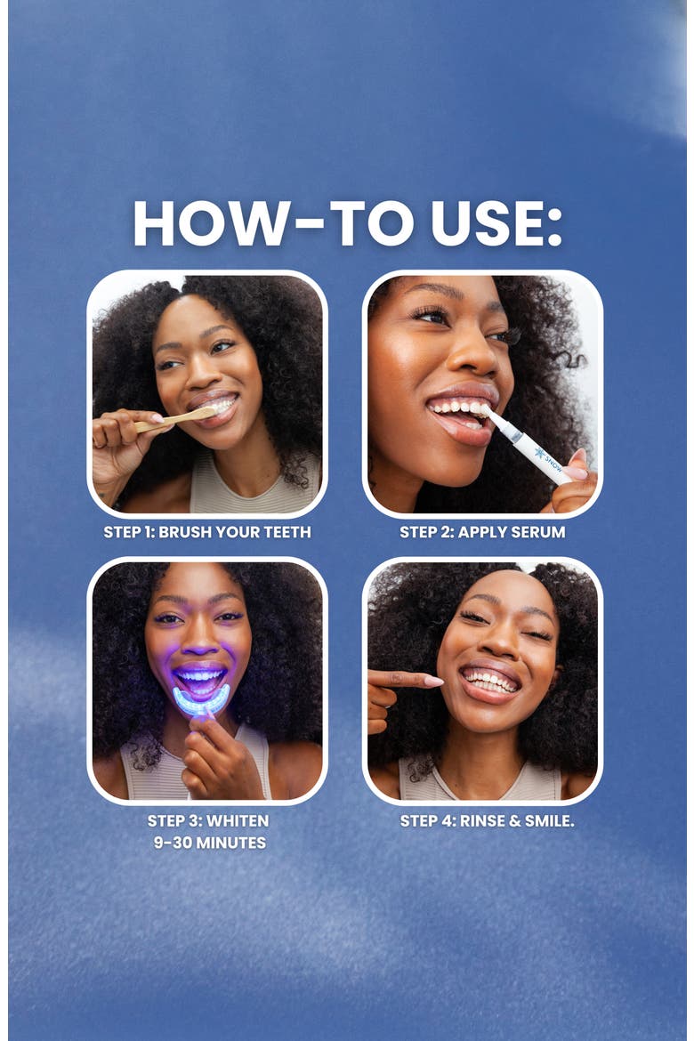 Diamond Teeth Whitening Kit, Alternate, color, WHITE