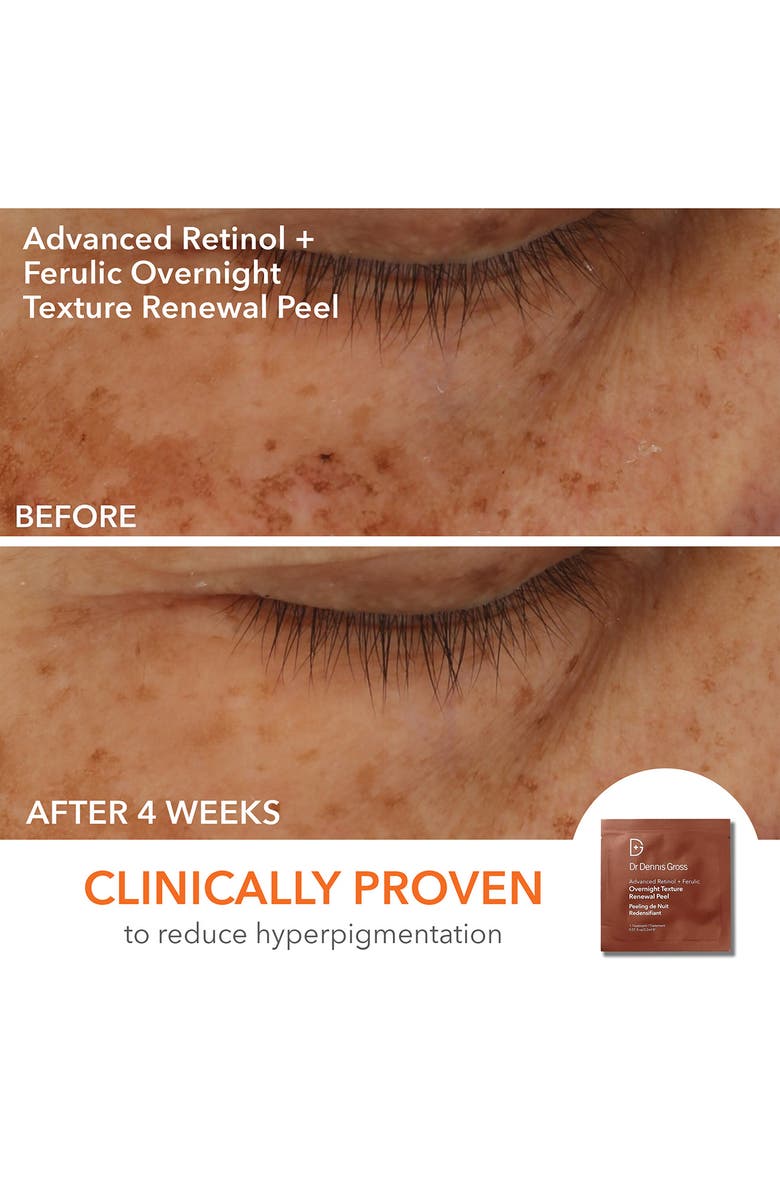 Dr. Dennis Gross Skincare Light It Up Faceware Bundle (Limited Edition) USD $598, Alternate, color, 