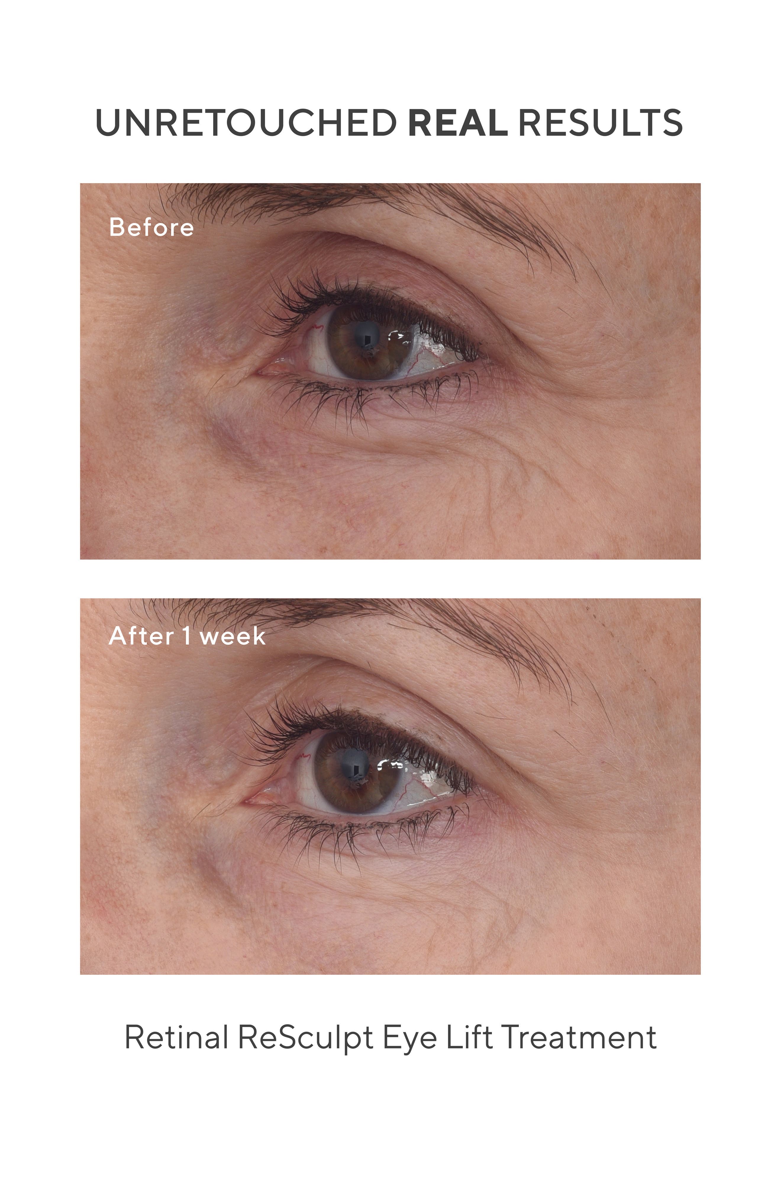 Retinal ReSculpt Eye Lift Treatment (Women) | Nordstrom
