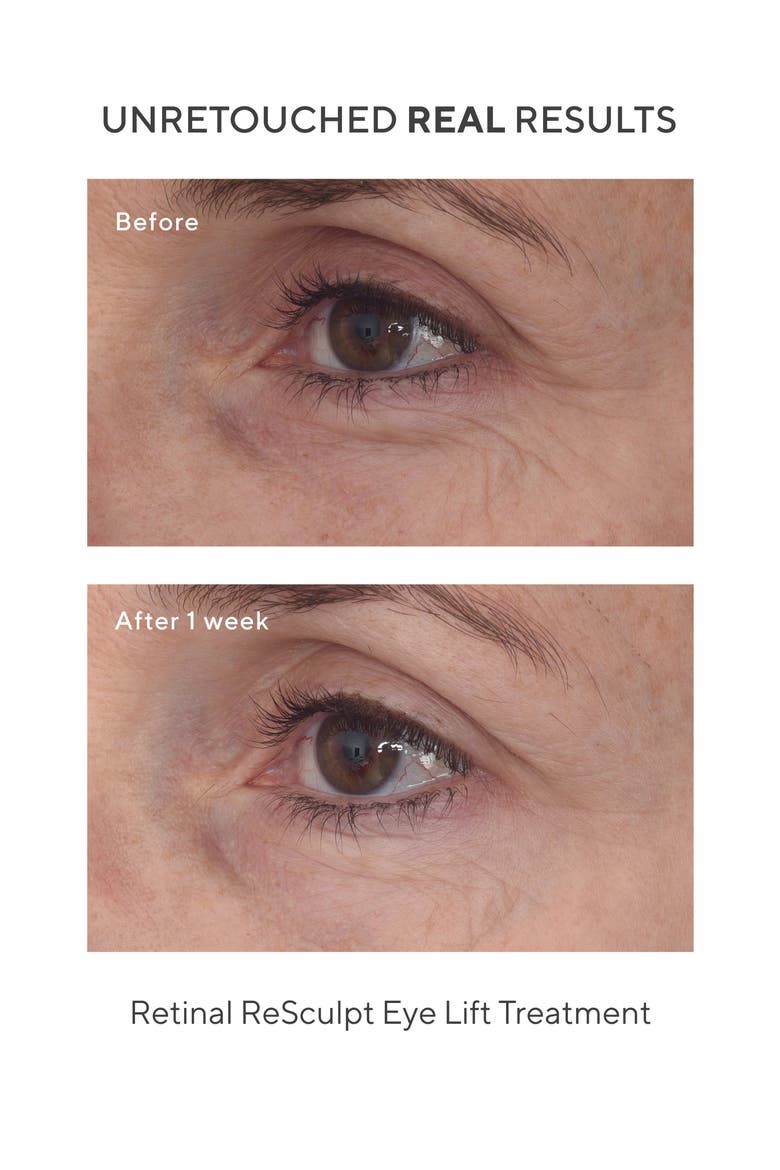 Retinal ReSculpt Eye Lift Treatment, Alternate, color, NONE