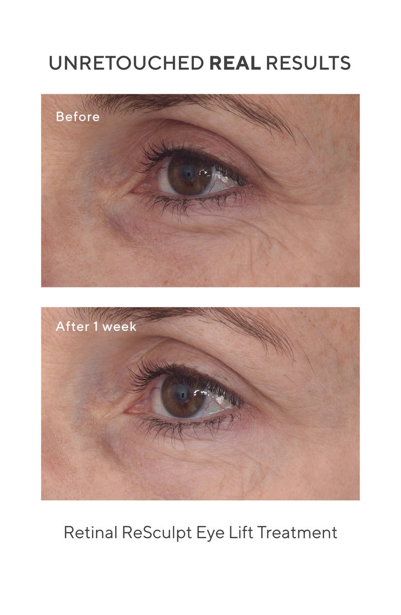 Murad<sup>®</sup> Retinal Resculpt Eye Lift Treatment, Alternate, color, 