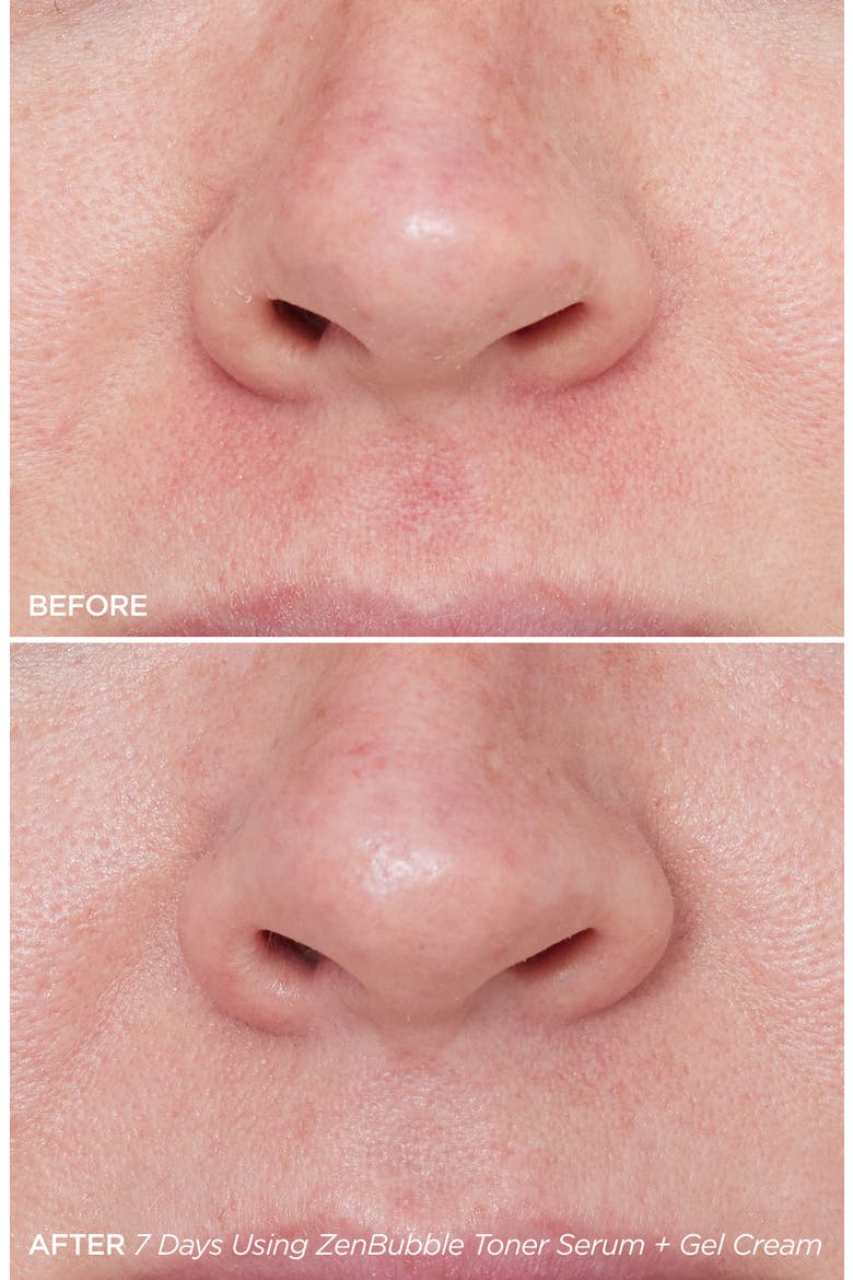 ZenBubble Bi-Phase Toner Serum, Alternate, color, NO COLOR