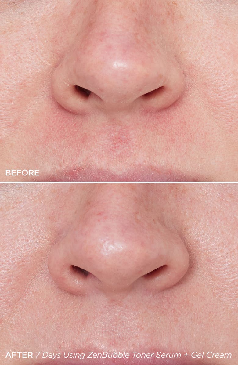 BeautyBio ZenBubble Bi-Phase Toner Serum, Alternate, color,