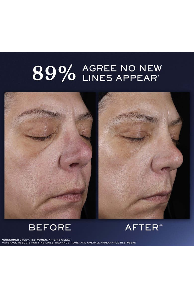 Lancôme Génifique Ultimate Recovery Serum, Alternate, color, 