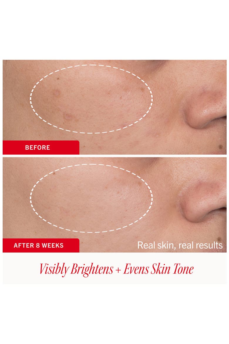 Brighten + Glow Dark Spot Serum, Alternate, color, NO COLOR
