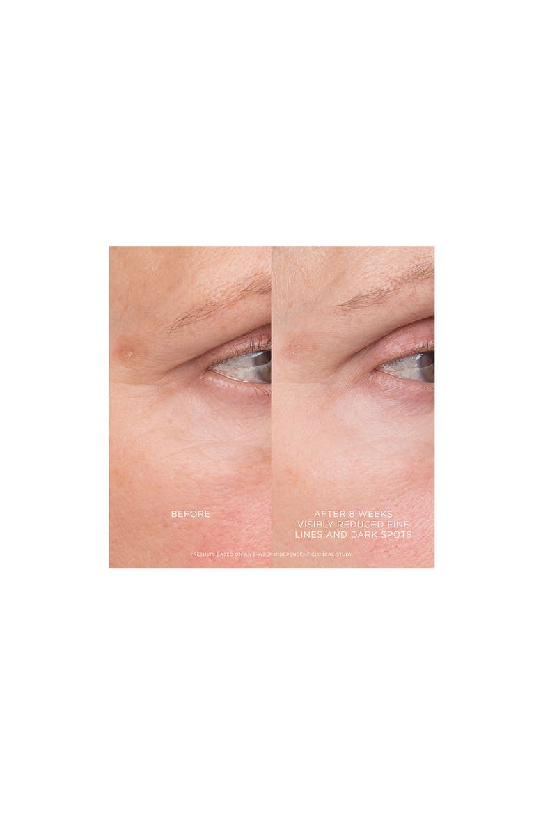 Equilibrium Resurfacing Retinoid Treatment, Alternate, color, NO COLOR