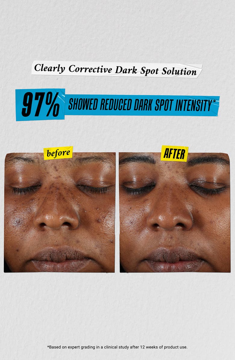 Kiehl's Since 1851 Best in Glass Skin Care Set $104 Value, Alternate, color,