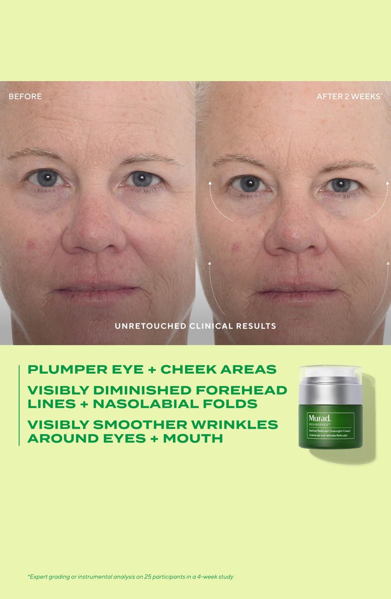 Murad<sup>®</sup> Retinal ReSculpt<sup>™</sup> Overnight Cream, Alternate, color,