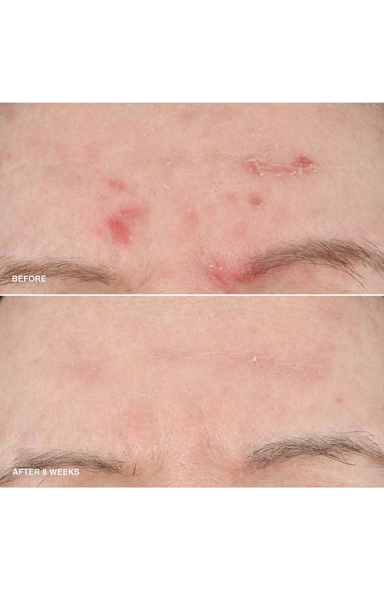 Bobbi Brown Vitamin Enriched Smoothing Niacinamide + Vitamin C Serum, Alternate, color,