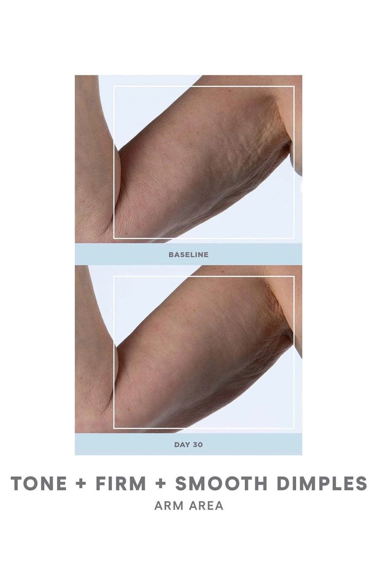 NuFACE<sup>®</sup> Refreshed NuBODY Skin Toning Device & Hydrating Aqua Gel Set, Alternate, color, 