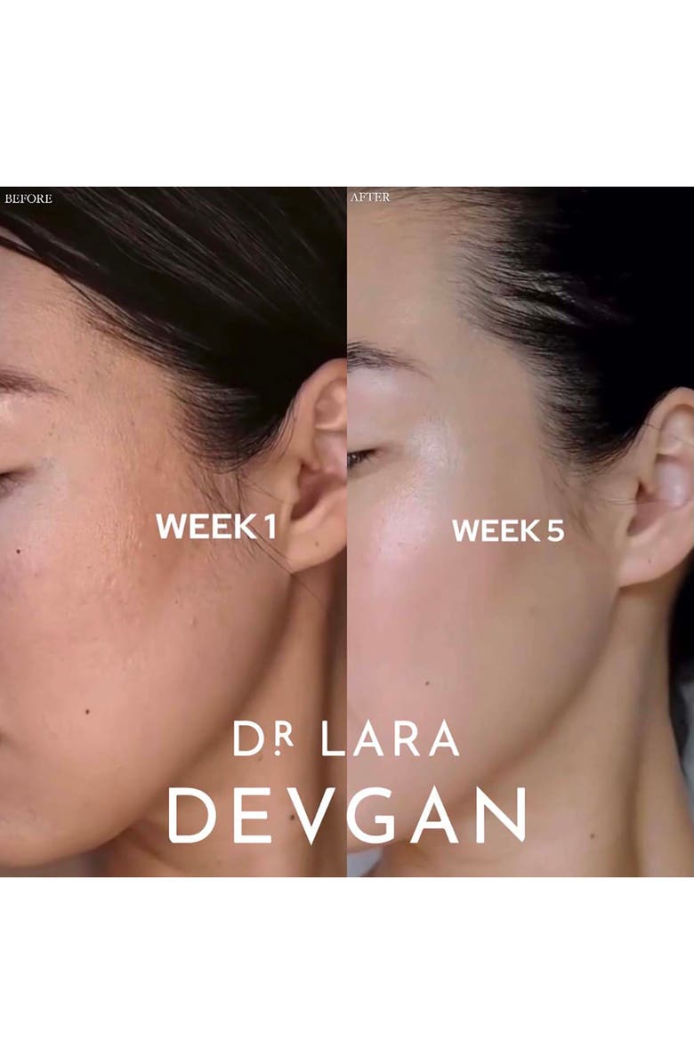 Dr. Lara Devgan Retinol + Bakchiol Serum, Alternate, color,