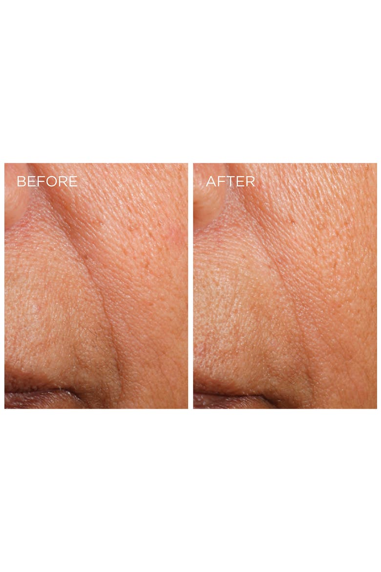Dermarché® Labs 'FullFill' Hyaluronic Acid Topical Wrinkle Filler, Alternate, color, NO COLOR