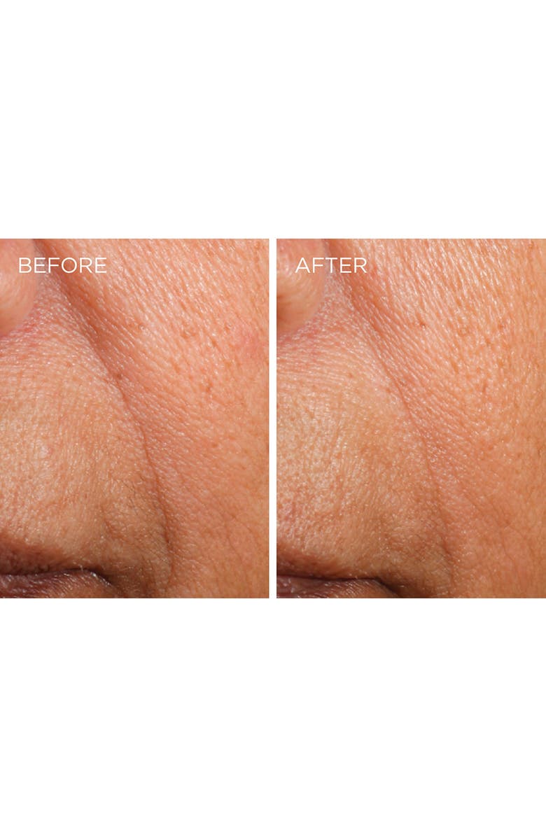 DERMARCHE LABS Dermarché<sup>®</sup> Labs 'FullFill' Hyaluronic Acid Topical Wrinkle Filler, Alternate, color, 