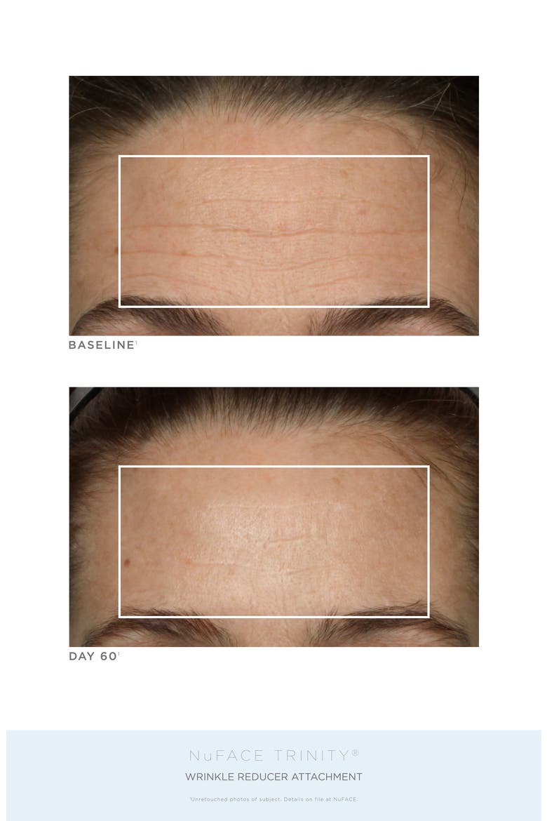 Trinity® Complete Facial Toning Kit (Limited Edition), Alternate, color, NO COLOR