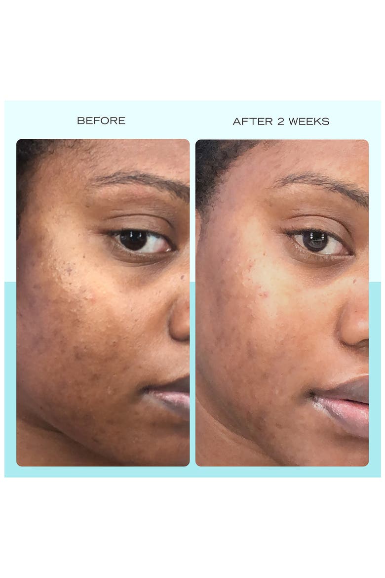 Dark Spot Serum with Niacinamide, Alternate, color, NO COLOR