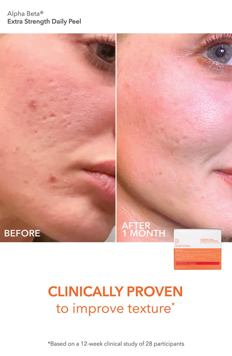 Dr. Dennis Gross Skincare Alpha Beta Daily Peel Vault Set $245 Value, Alternate, color, 