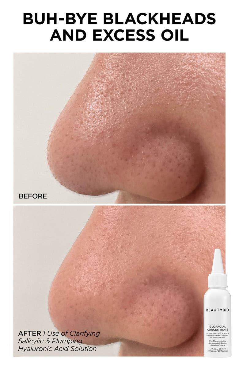 BeautyBio VIP GLO Ultimate Hydration Facial Set (Nordstrom Exclusive) $347 Value, Alternate, color,