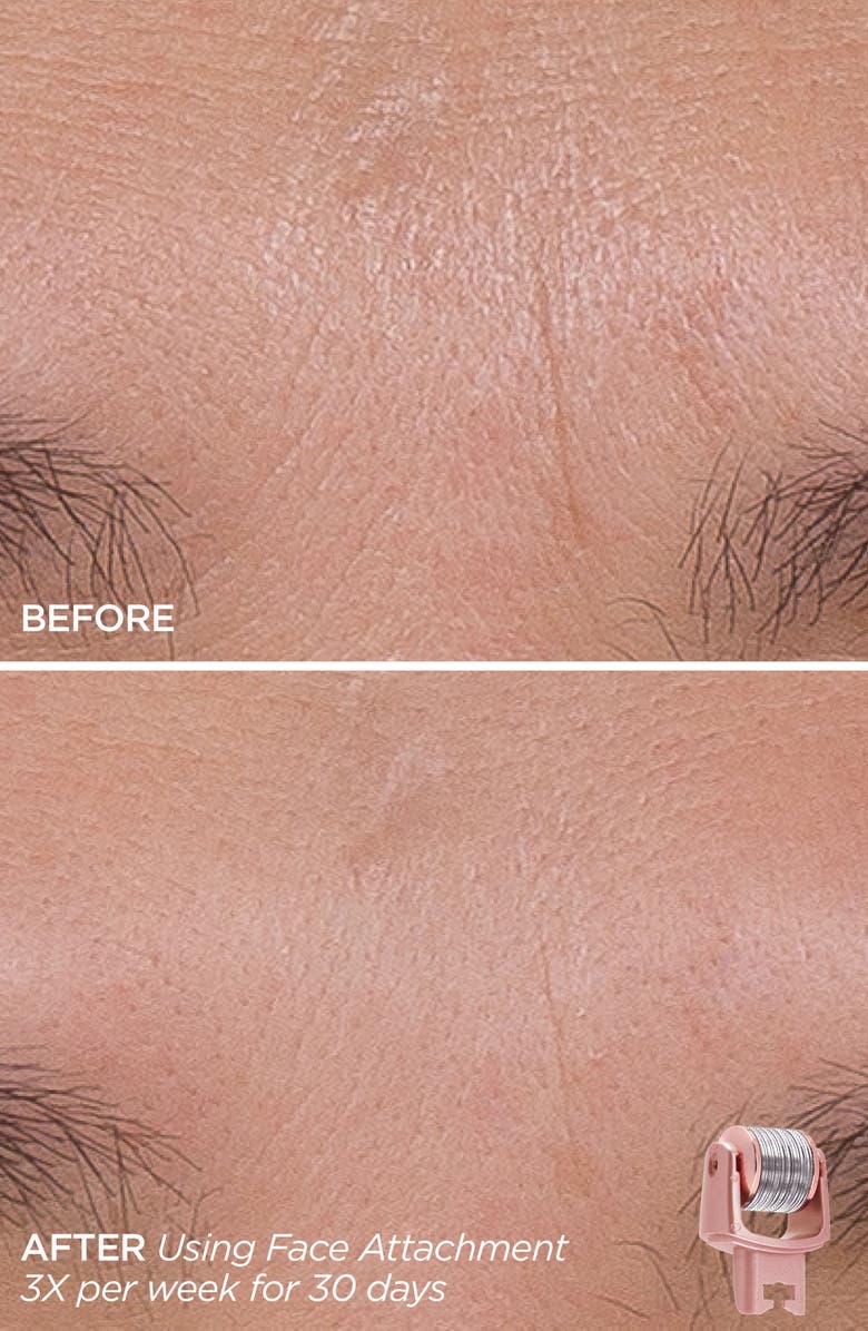 BeautyBio GloPRO<sup>®</sup> Skin That Glitters Set, Alternate, color, 