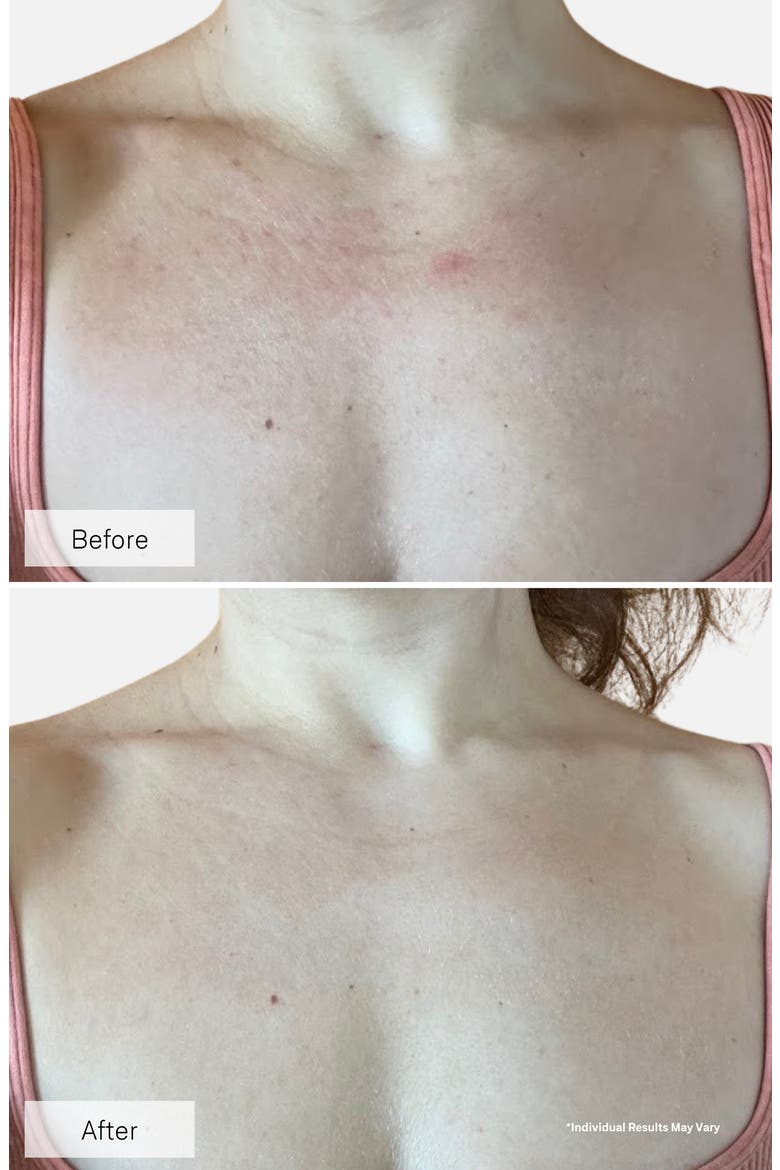 Contour Neck & Décolleté LED Device (Nordstrom Exclusive), Alternate, color, NO COLOR