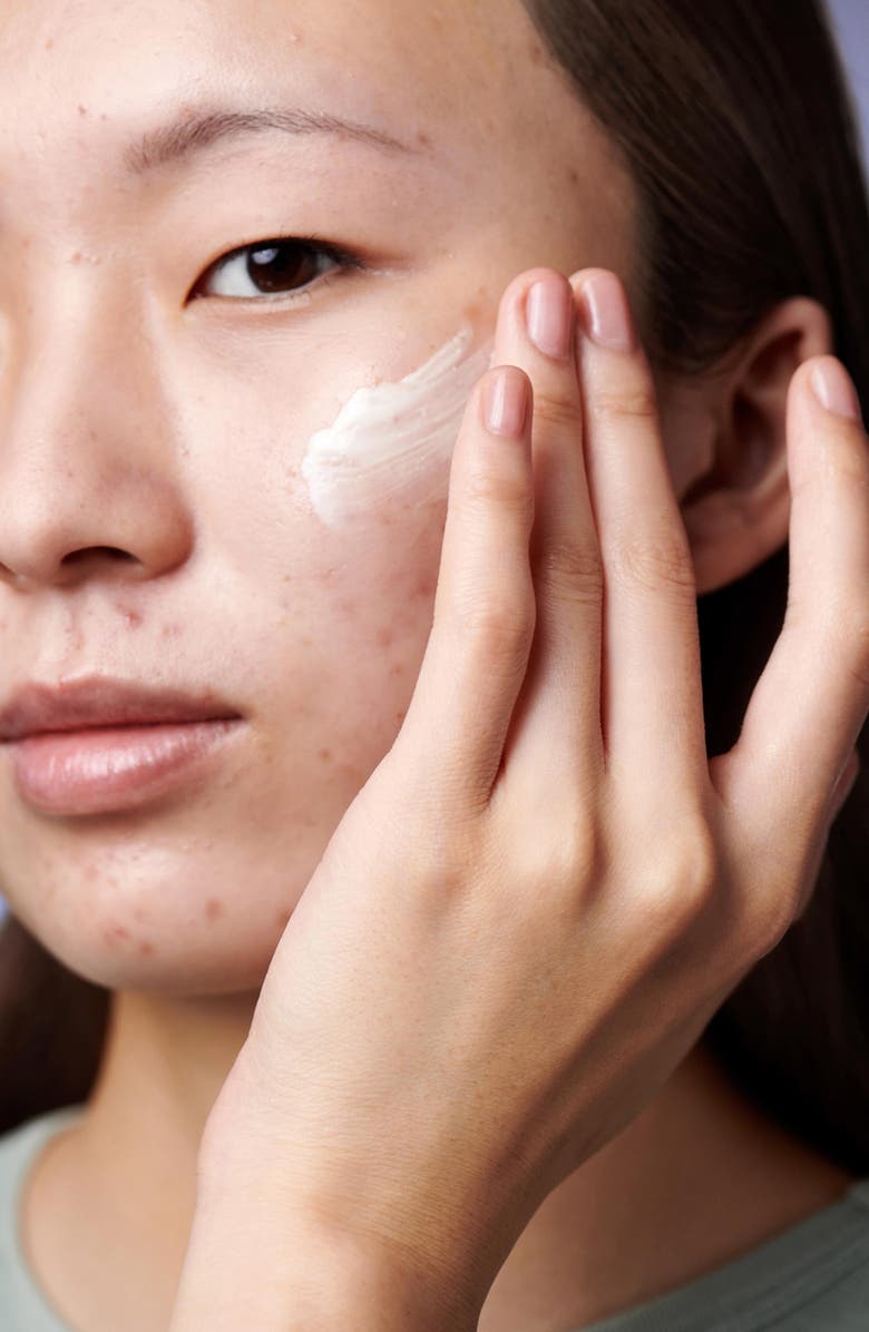 Hero Rescue Retinol, Alternate, color, 