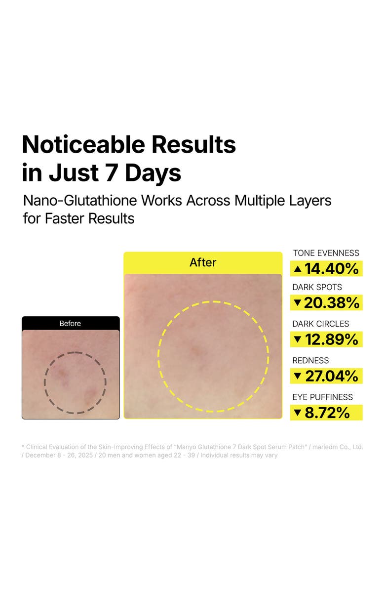 ma:nyo Glutathione 7 Dark Spot Serum Patch, Alternate, color, Light/ Pastel Yellow