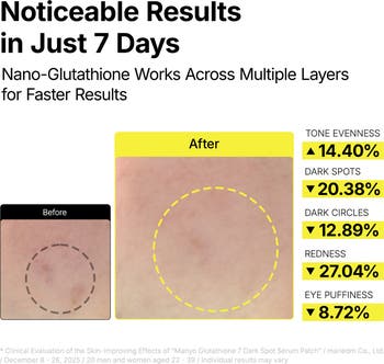 glutathione color [ma:nyo] Glutathione 7 Dark Spot Serum Patch (30 pcs)