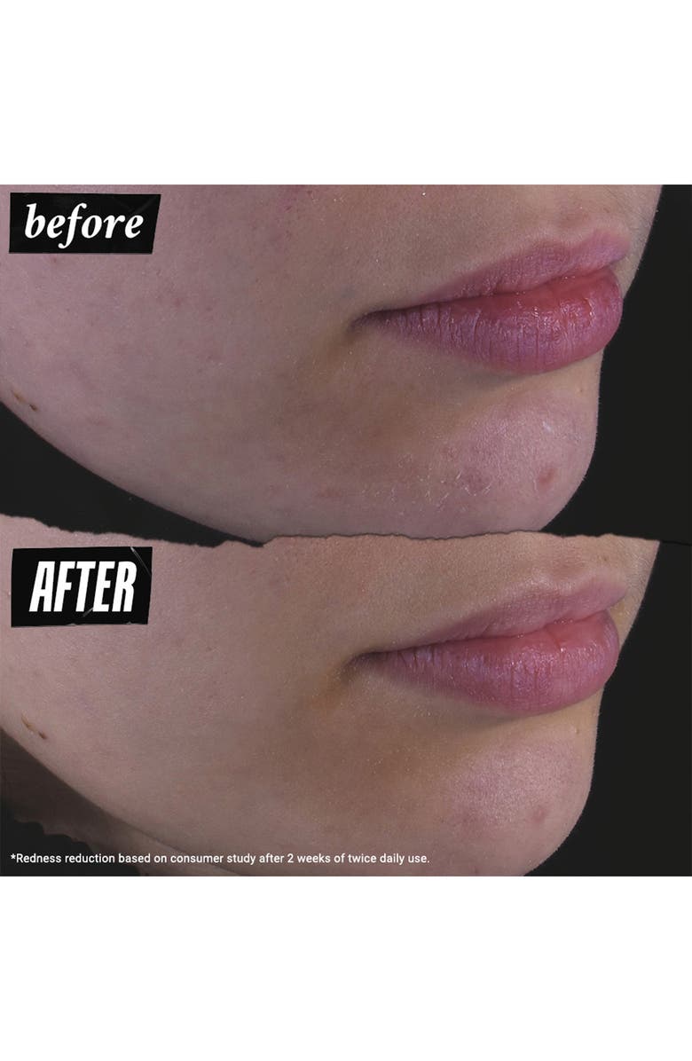 Kiehl's Since 1851 Calendula Herbal Extract Alcohol Free Toner, Alternate, color, 