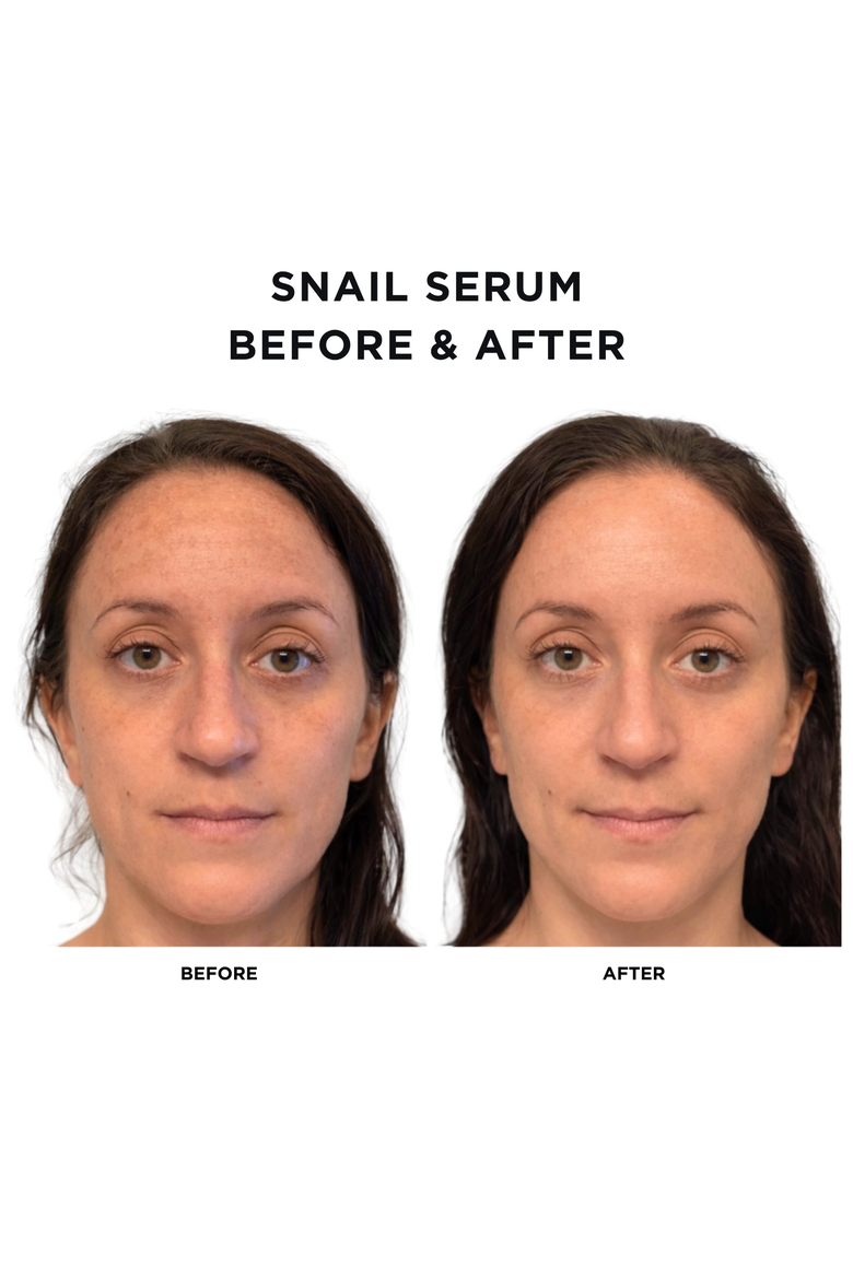 Snail Serum + Mini Snail Serum | Full Size 1 fl oz/ 30 ml & Travel Size 0.17oz/5ml |Hydrating & Anti-Aging Skincare Treatment with Vegan Snail Venom Peptide & Vegan Snail Mucin, Alternate, color, None