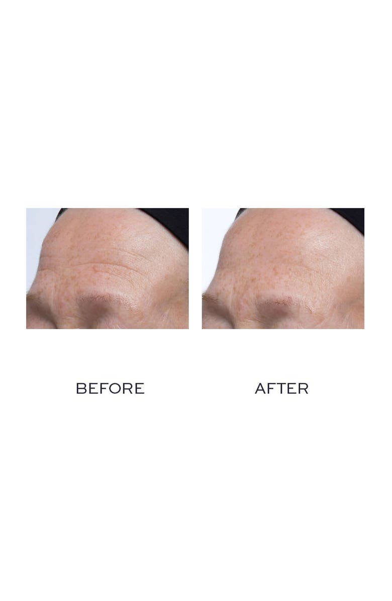 Elemis Ultra Smart Pro-Collagen Complex 12 Serum, Alternate, color,