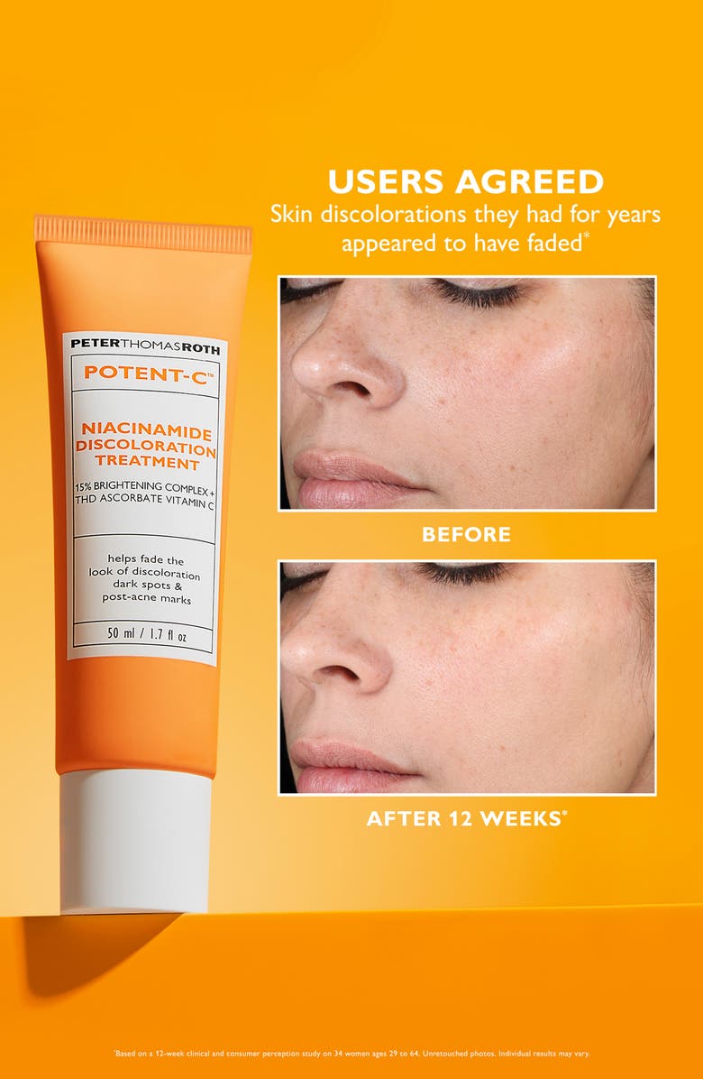 Peter Thomas Roth Potent-C Niacinamide Discoloration Treatment, Alternate, color,