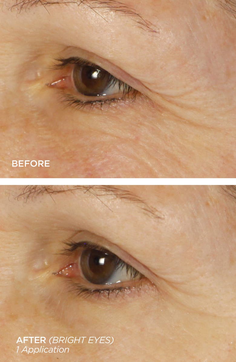 BeautyBio Bright Eyes Collagen-Infused Eye Gels & Sleep Mask Set, Alternate, color,