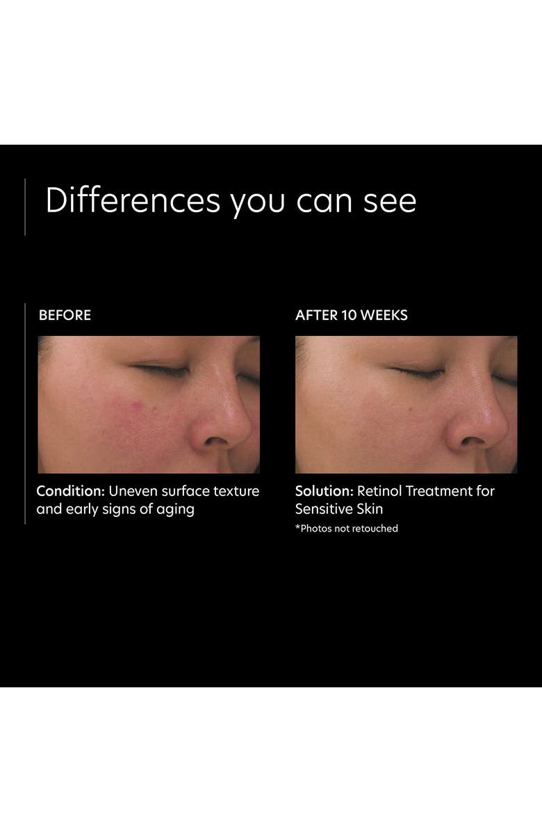 PCA Skin Retinol Treatment for Sensitive Skin, Alternate, color,