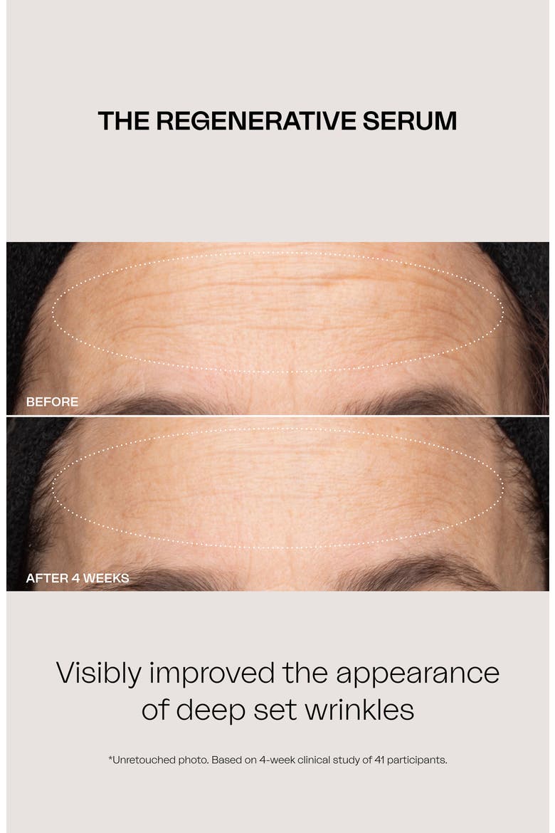 The Regenerative Serum Duo $650 Value, Alternate, color, NO COLOR