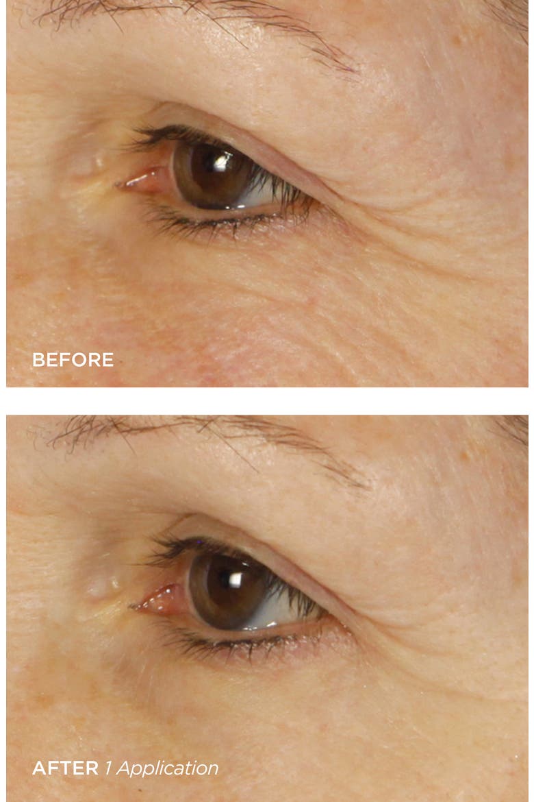 Bright Eyes Illuminating Colloidal Silver + Collagen Eye Patch, Alternate, color, NO COLOR