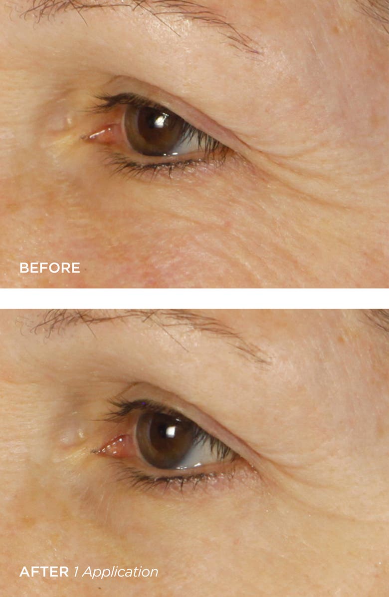 BeautyBio Bright Eyes Illuminating Colloidal Silver + Collagen Eye Patch, Alternate, color,