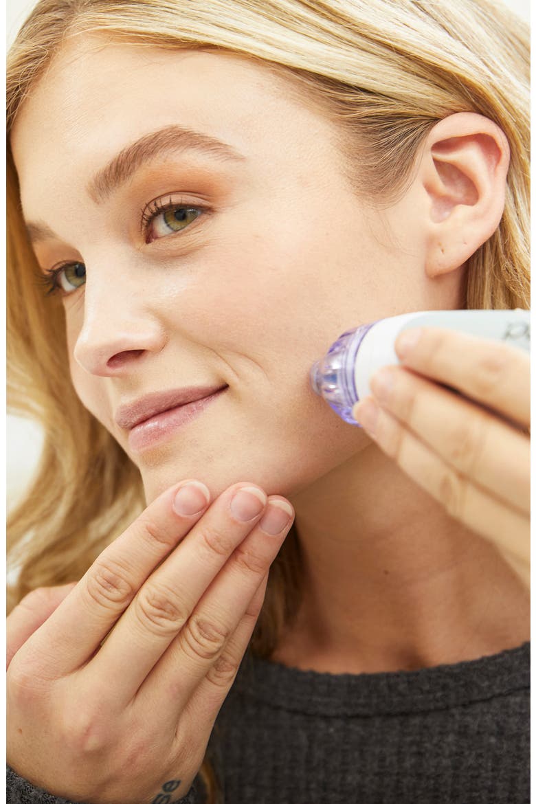 Personal Microderm Classic Device and Hand & Foot Kit USD $179 Value, Alternate, color, NO COLOR