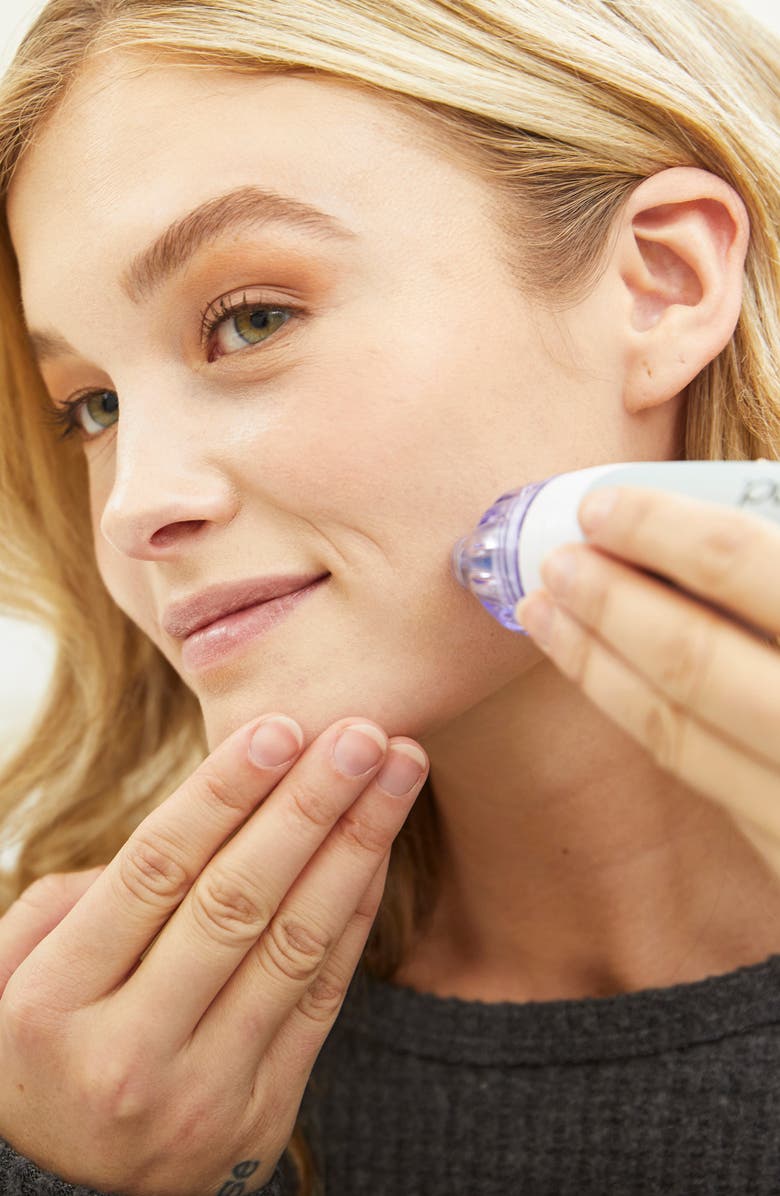 PMD Personal Microderm Classic Device and Hand & Foot Kit USD $179 Value, Alternate, color, 