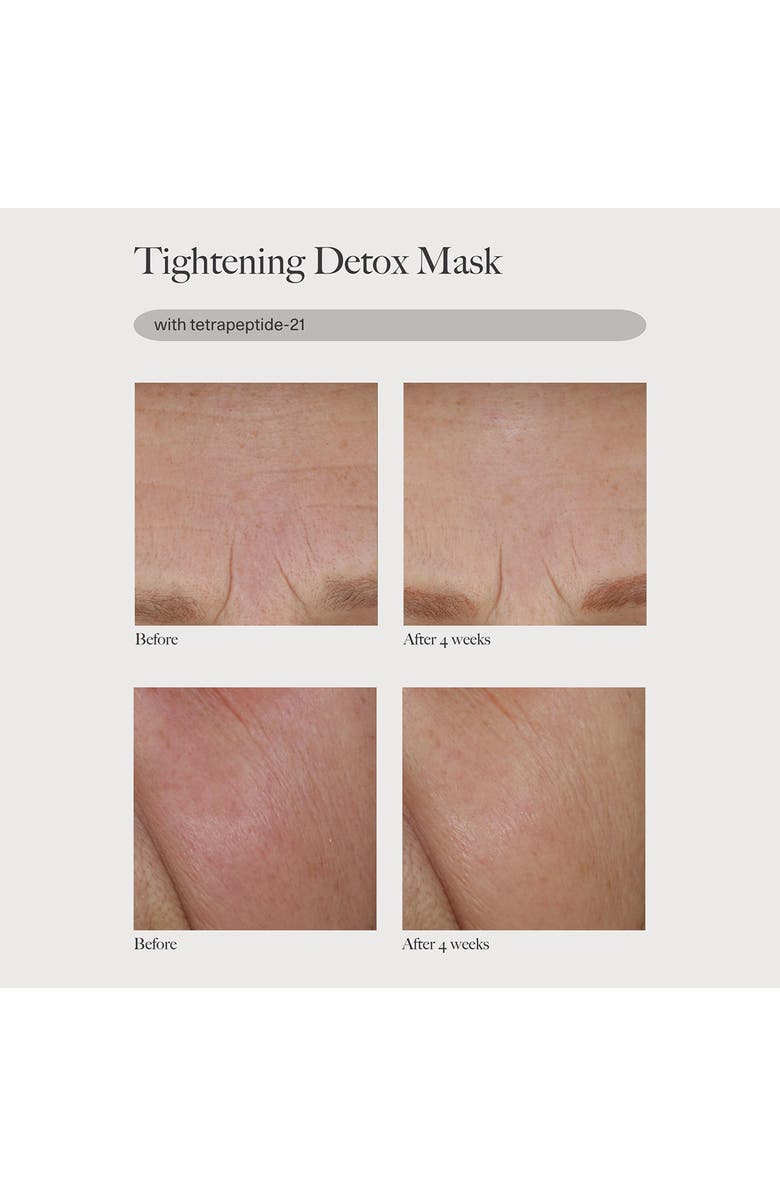 Dr. Loretta Tightening Eye Gel, Alternate, color,