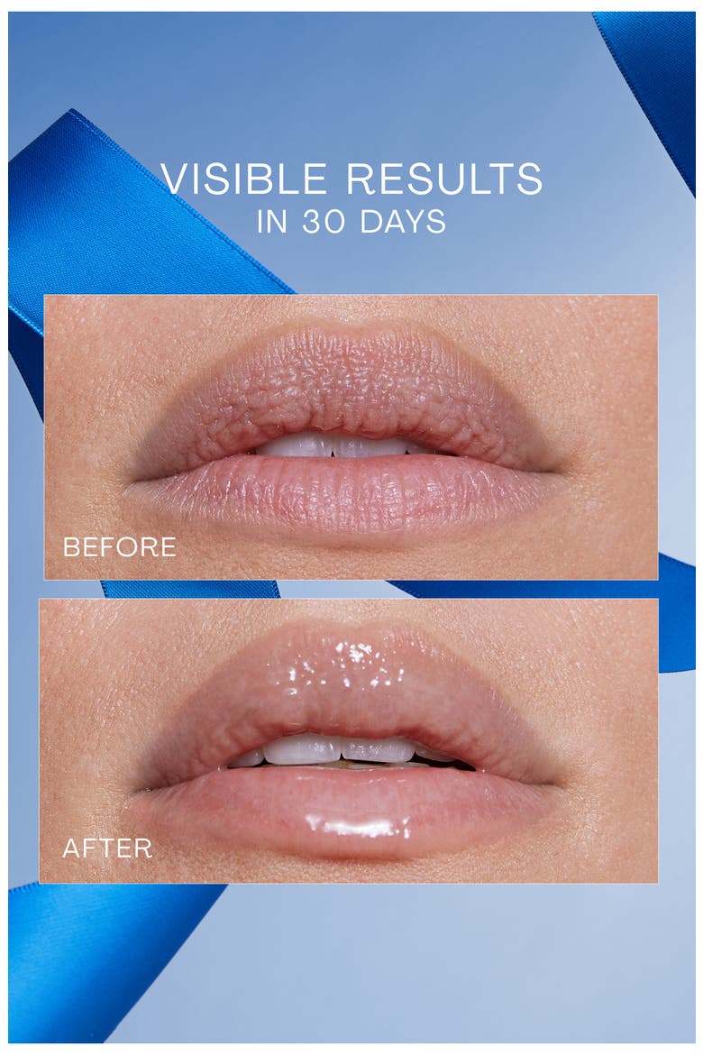 Lip Oasis Glossy Treatment The Complete Collection $112 Value, Alternate, color, NO COLOR