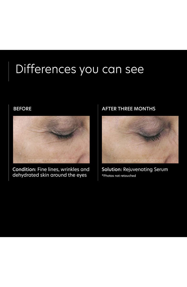 PCA Skin Rejuvenating Serum, Alternate, color, 