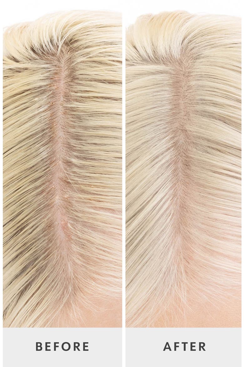 Crown Tonic™ Pre-Shampoo Scalp-Balancing Cleanser, Alternate, color, NO COLOR