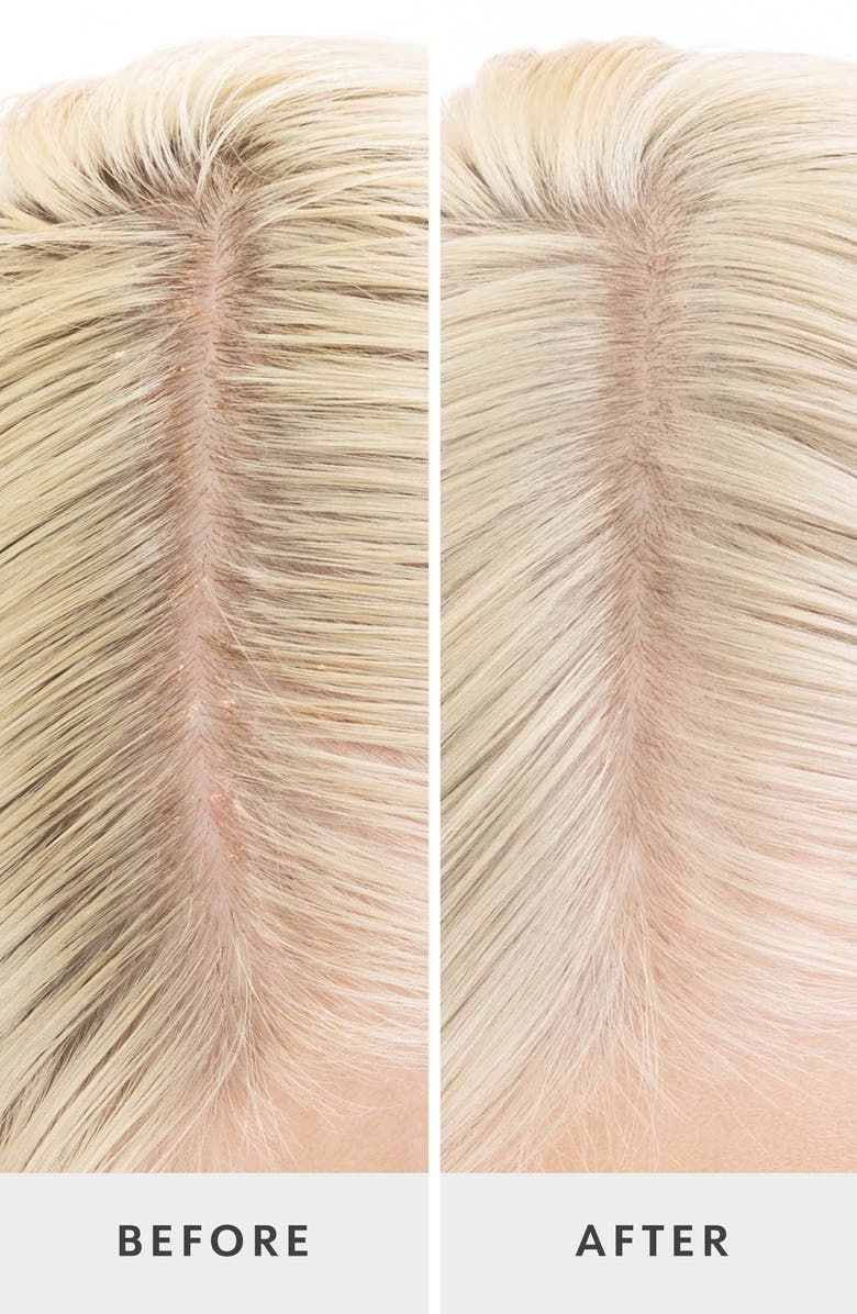 Drybar Crown Tonic<sup>™</sup> Pre-Shampoo Scalp-Balancing Cleanser, Alternate, color, 