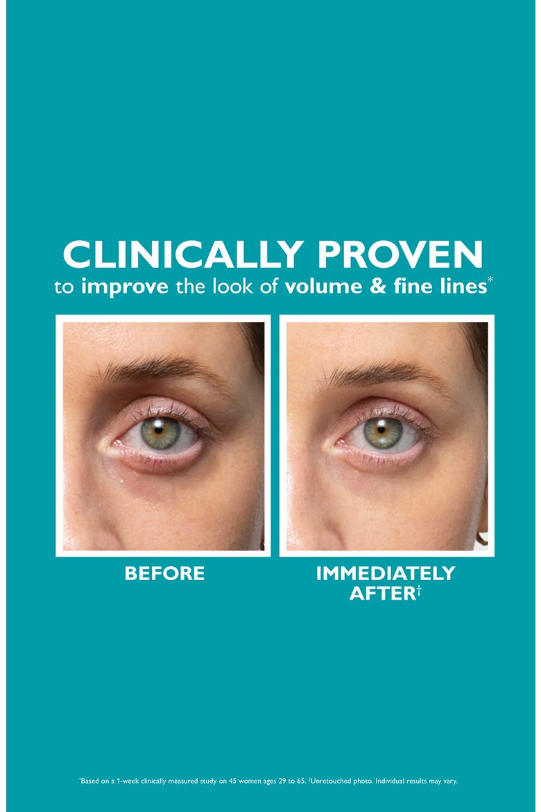 Peptide Skinjection Fill + Fix Under-Eye Cream, Alternate, color, NO COLOR