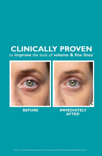 Peptide Skinjection Fill + Fix Under-Eye Cream