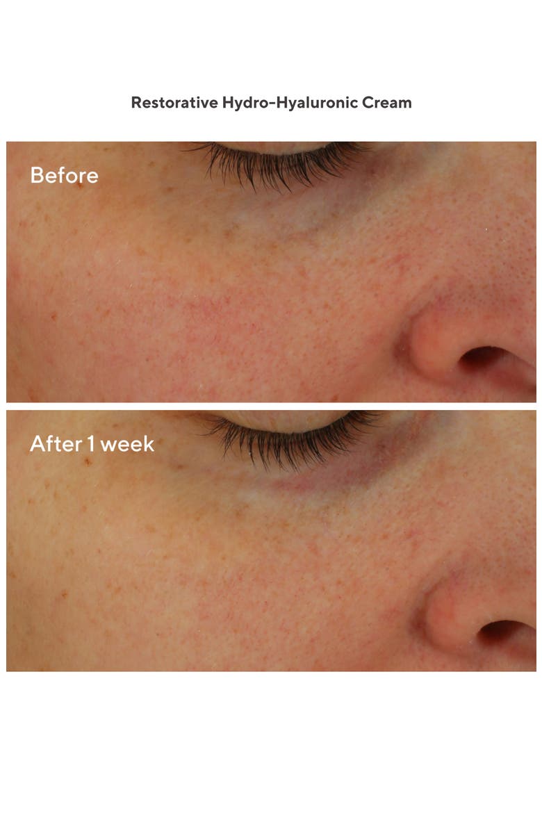 Restorative Hydro-Hyaluronic Cream, Alternate, color, NO COLOR